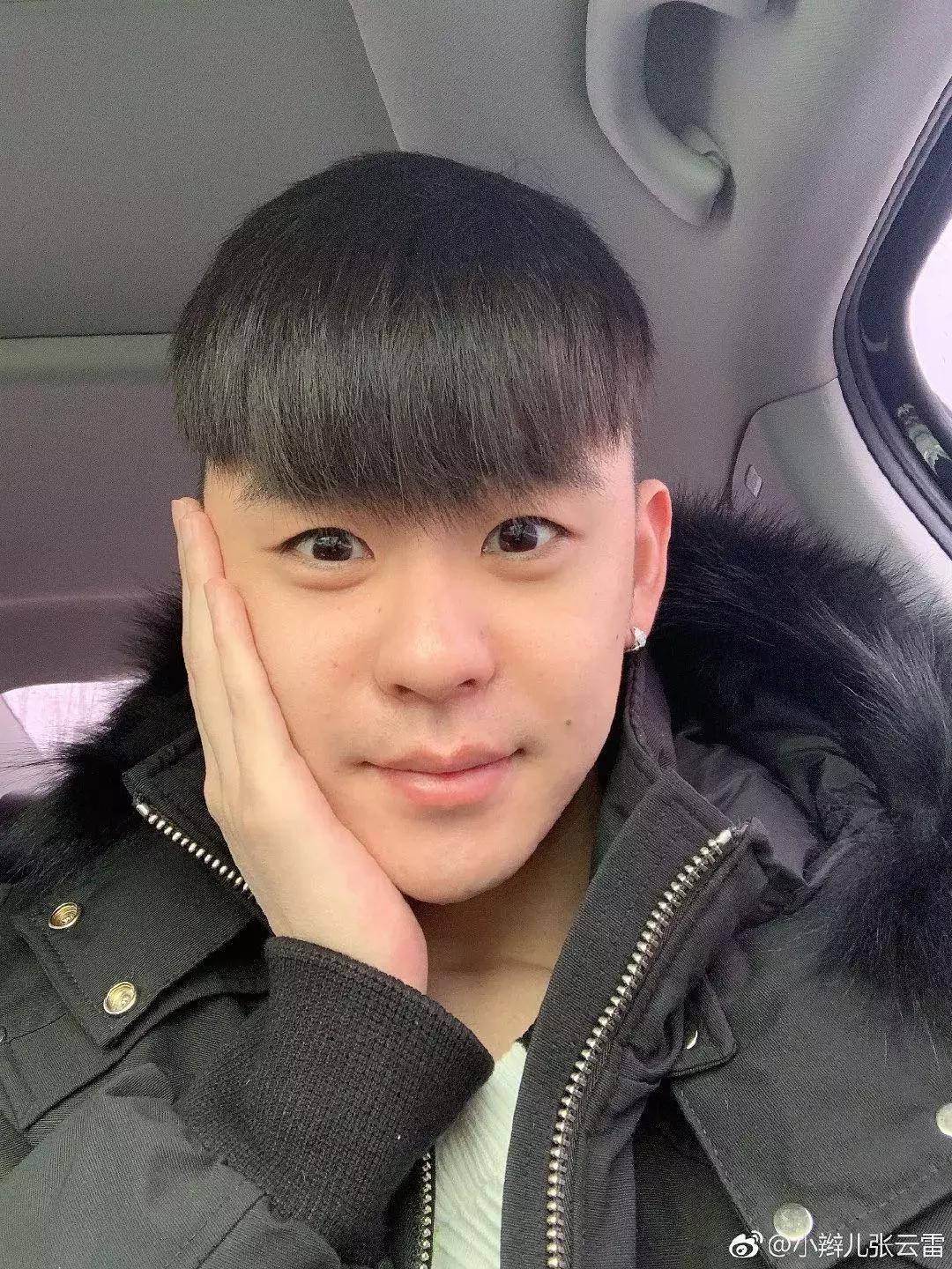 张云雷“渡劫”归来：手术取出全身钢钉，恢复不到一月便急回舞台