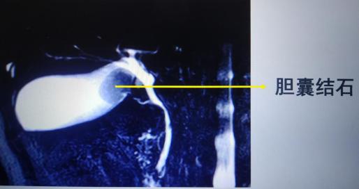 突发肚子疼呕吐是阑尾炎吗,突发恶心腹痛是什么原因
