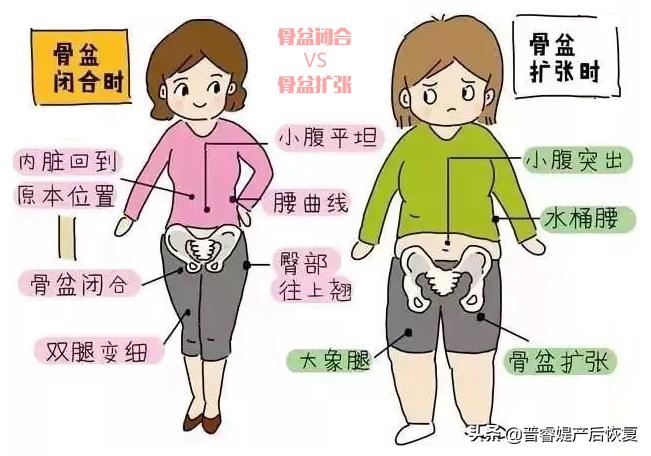 什么是产后修复项目,骨盆修复是指什么修复