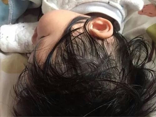 为什么好多小孩睡觉不出汗,白天不出汗晚上出汗是什么症状