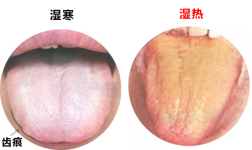 湿气重便秘肚子大怎么排湿减肥,湿气重的人舌苔厚怎么排湿