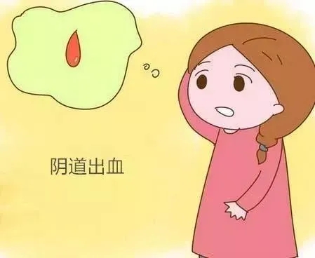 更年期女性一直出血怎么办,女人更年期会有出血的现象吗