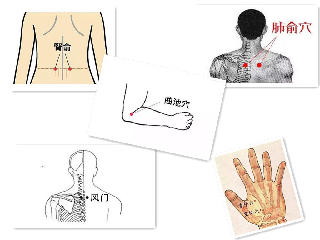 天气冷支气管炎反复发作怎么办,天气冷了支气管炎一直咳嗽怎么办