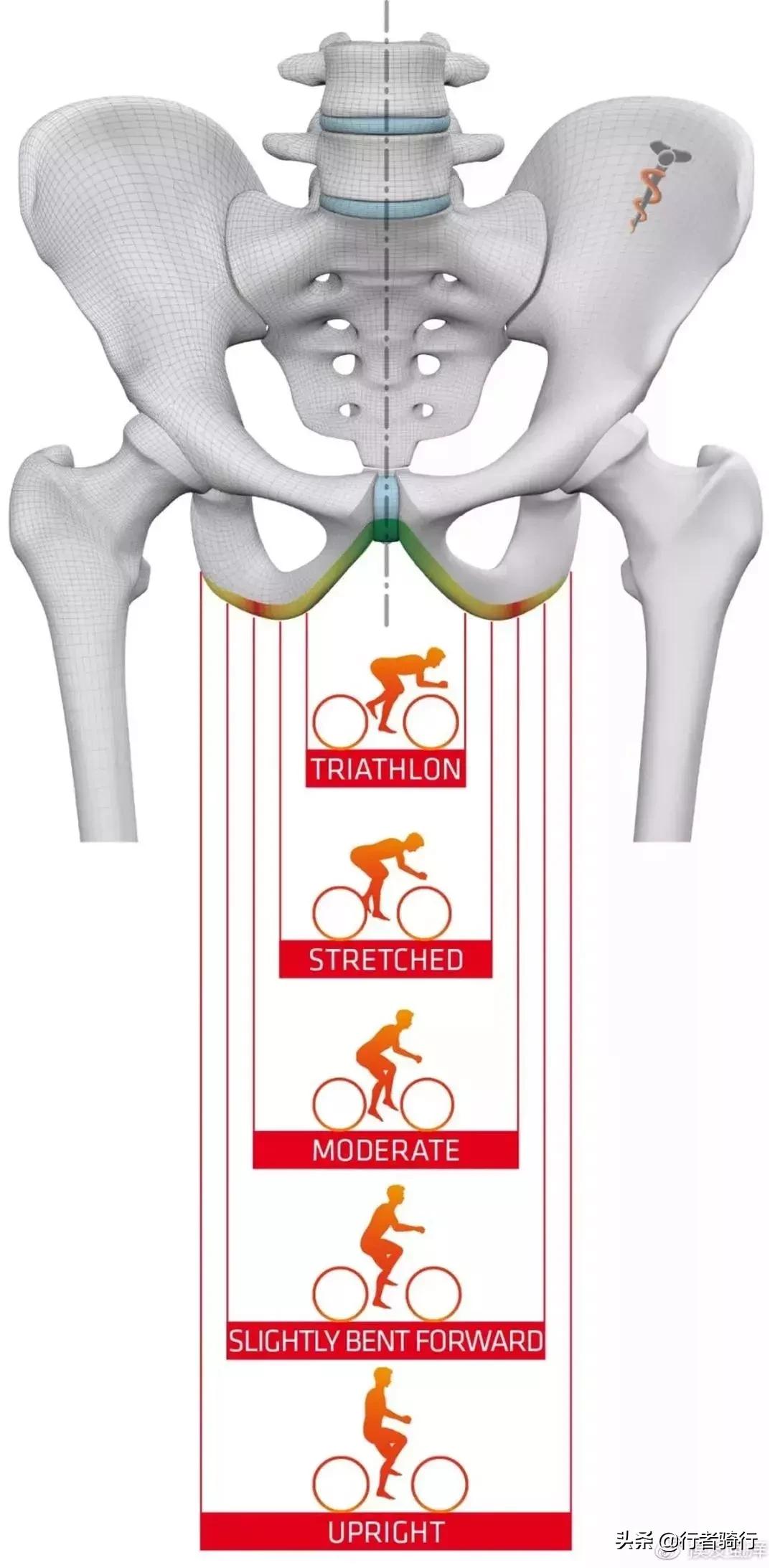 骑车屁股疼怎么解决挂什么科,骑车子屁股疼