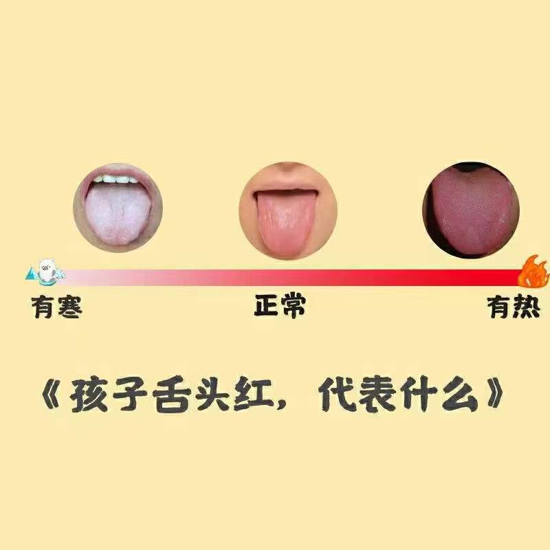 一招教你看舌苔图片,一张图看懂孩子学习