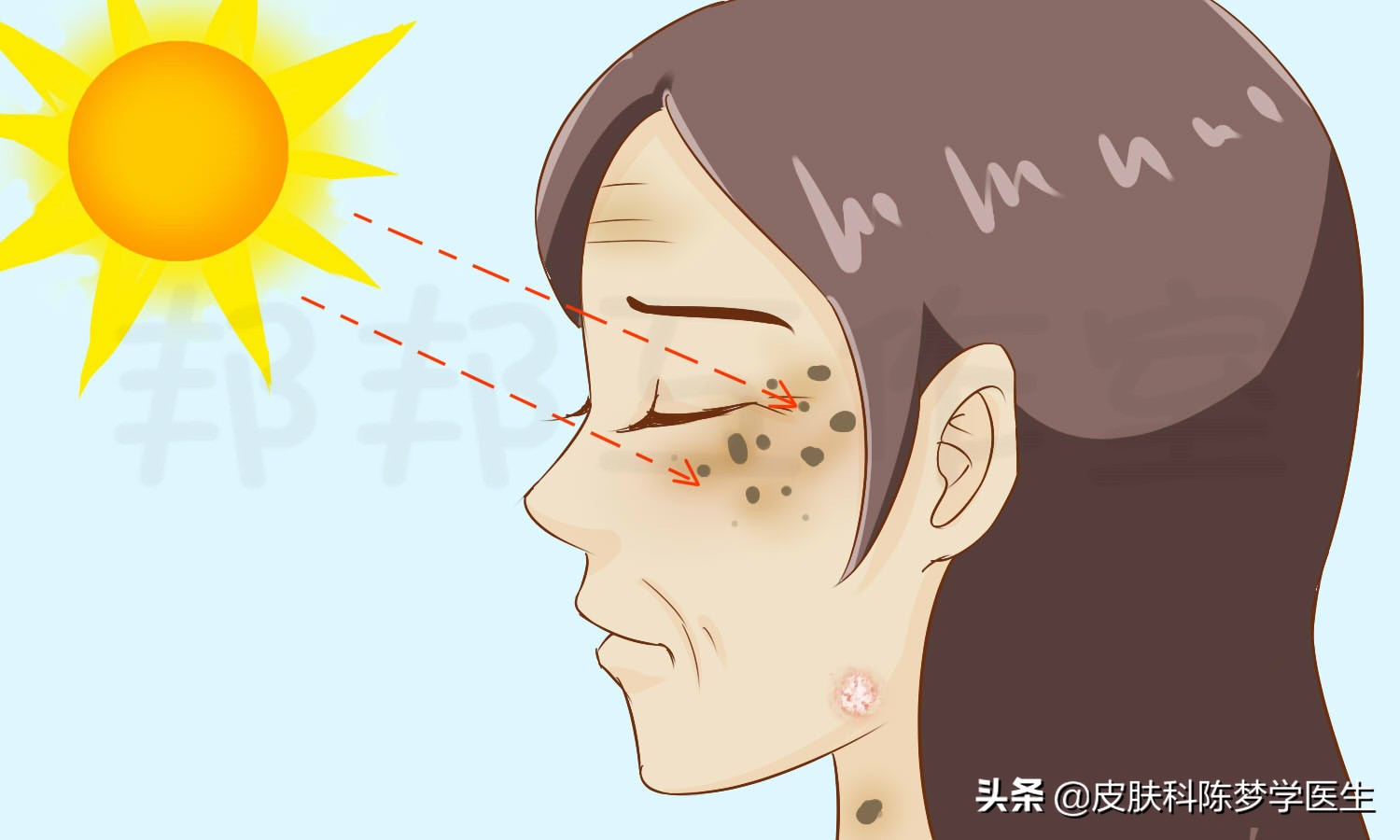 皮肤病是上辈子做错了什么吗,皮肤病是父母遗传问题吗