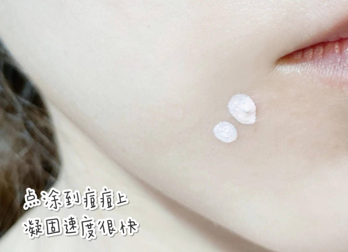 痘痘好多了脸一直红,痘痘反复没完没了