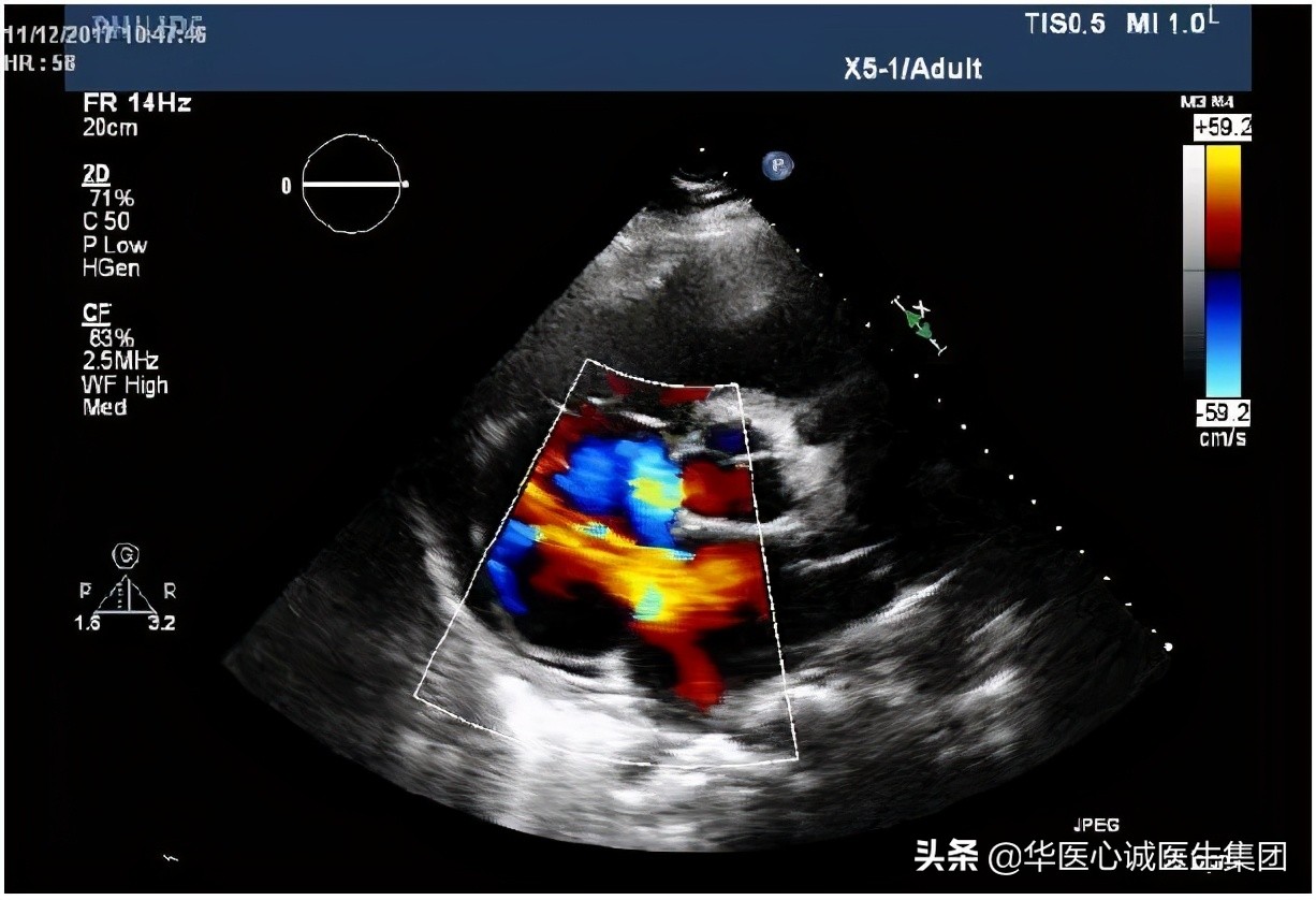 杨颖局部图,杨颖早期下颌宽大