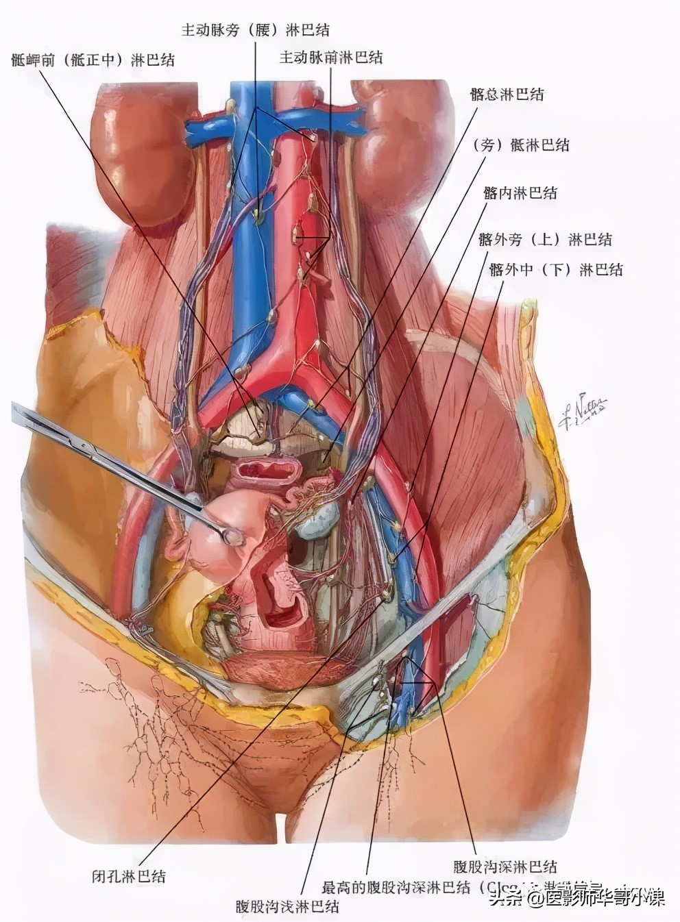 女性盆腔核磁解剖图谱,正常盆腔ct解剖图谱