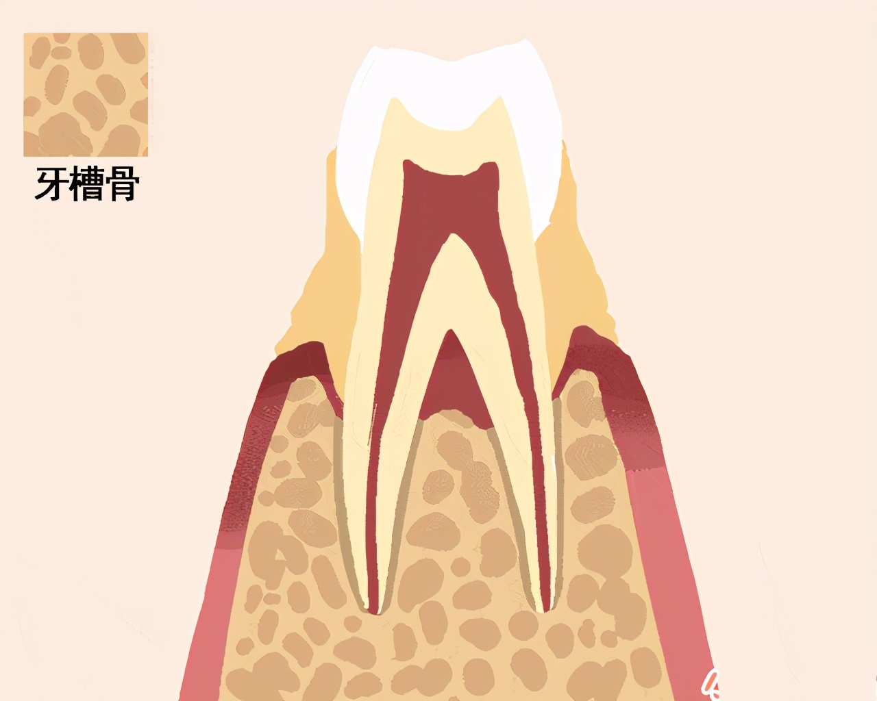 上海牙齿松动怎么修复,牙齿松动修复固齿医院