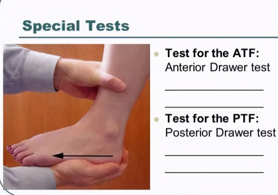 踝关节扭伤后绑护踝更痛了,踝关节扭伤用护踝要用多久