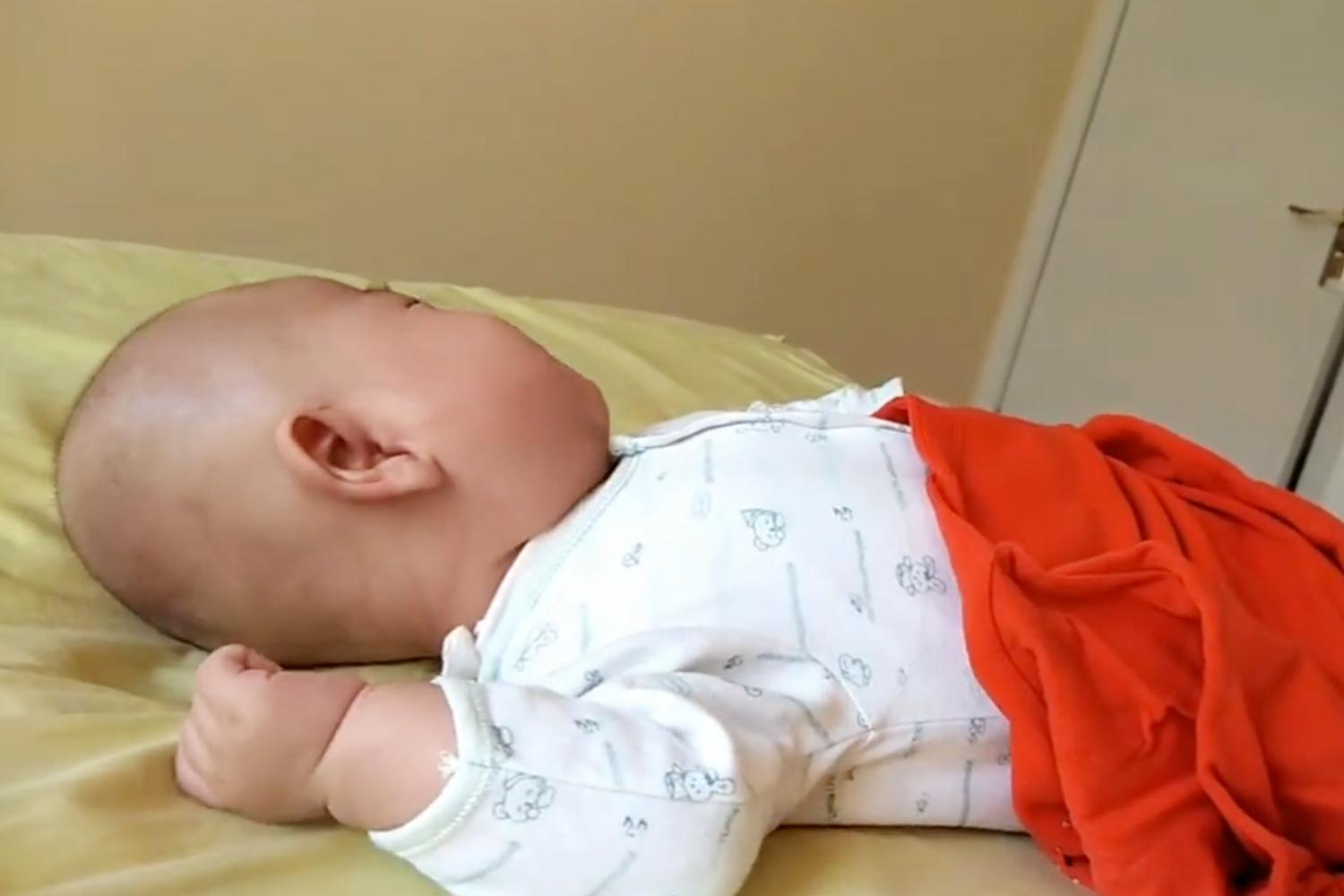 新生儿头型偏长如何睡圆,青年扁头可以通过睡姿矫正吗