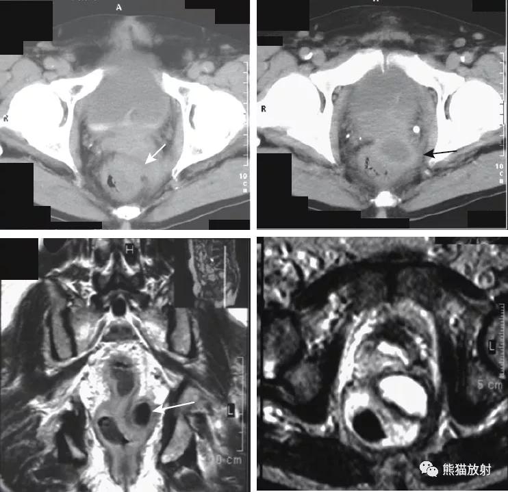腹部影像图片大全,乙状直肠疼痛位置图片