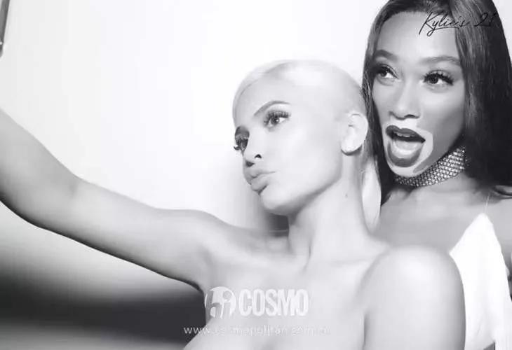 库兹马女朋友有白癜风会全白吗,库兹马与白癜风超模女友海边度假