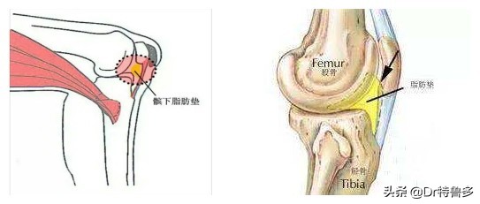 膝盖疼应该知道的几件事,膝眼痛考虑何病