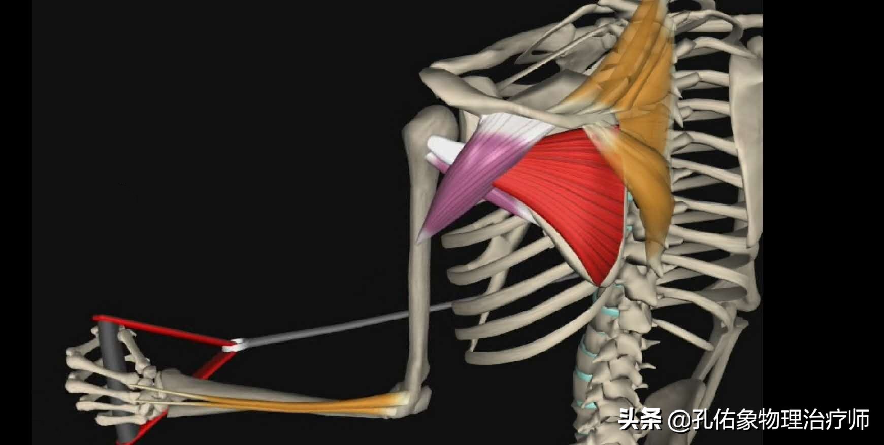 肩周炎如何防冻结肩,肩周炎爬墙抬肩怎么办