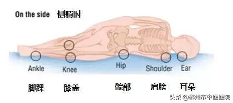 夏天卧床怎么预防褥疮,卧床病人预防褥疮的护理措施