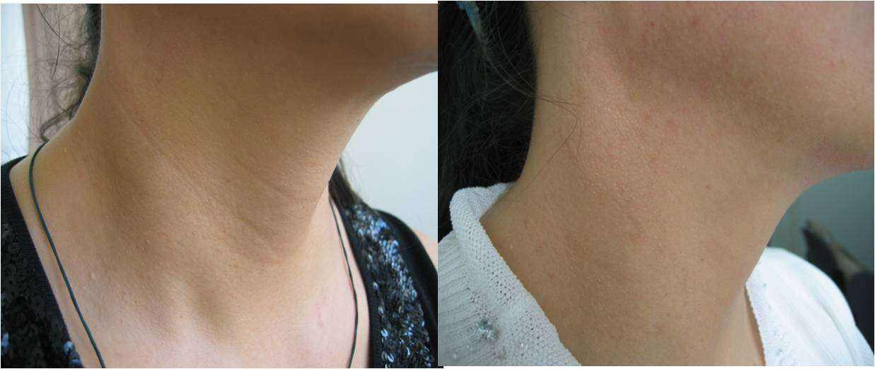 排名前十的颈纹霜有哪些,改善颈纹颈霜让你拥有天鹅颈