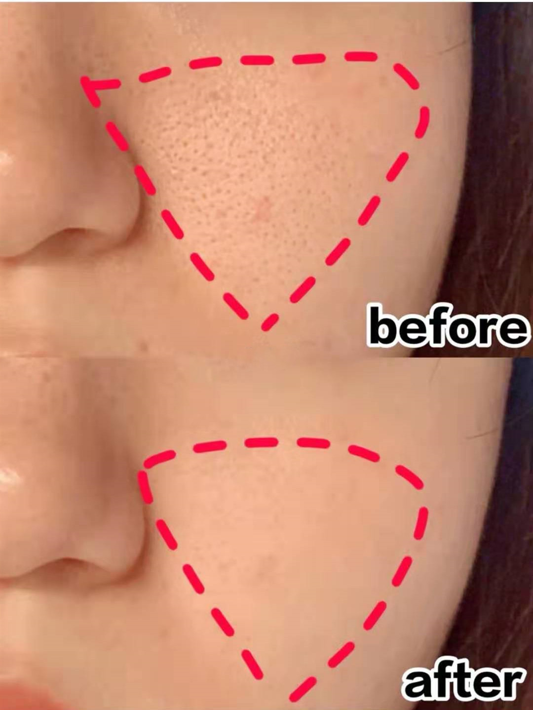 女子为变美花掉300余万后续,女子为变美脸塌陷