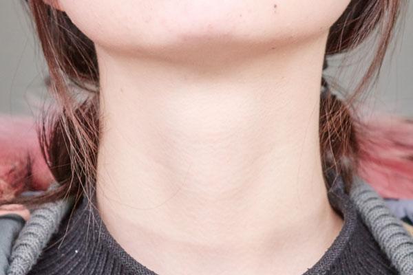 脖子上长小肉粒就一个,脖子上长小肉粒有没有危险