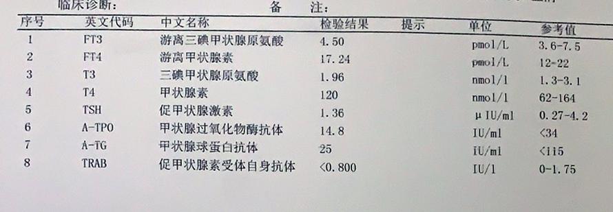 甲亢引起的眼球突出多久能恢复,甲亢导致眼球突出四五年了