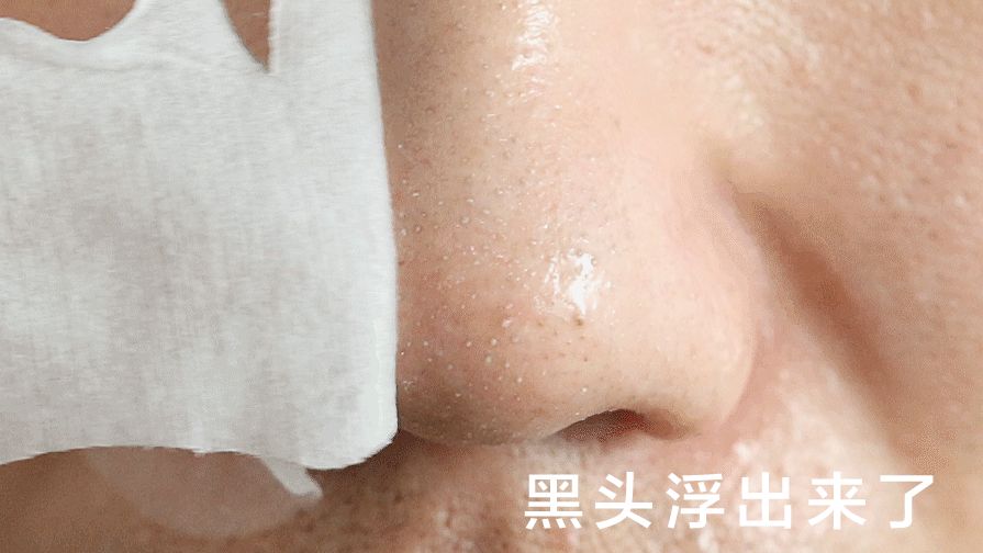 去黑头小窍门轻轻松松黑头一扫光,黑头太顽固教你去黑头的方法