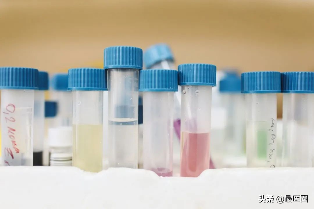 看似平平无奇的尿液,在向我们身体发出了什么警报?