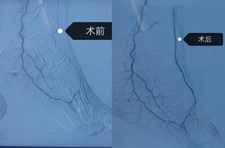 秦皇岛治糖尿病的医院,秦皇岛市军工医院治疗白塞氏病