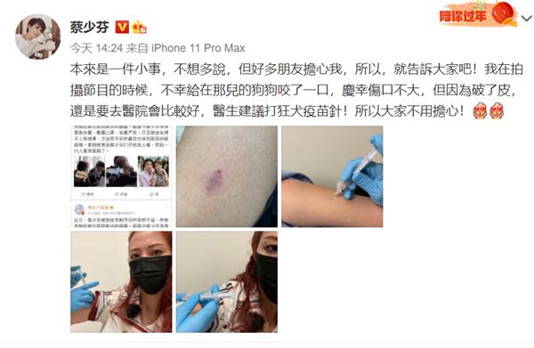 蔡少芬上节目打疫苗,蔡少芬录节目时被狗咬伤