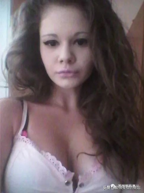 20次整容成功的女人,22岁女人做20次丰唇手术