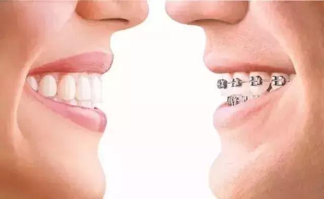 Helen齿科中心——牙齿不齐•影响健康