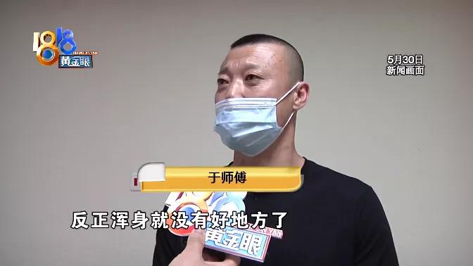 烫伤后不要过于紧张,烫伤后紧急处理