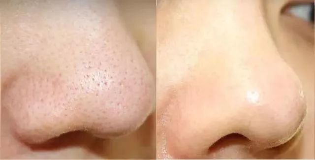 日本takami美容液,takami角质美容液测评