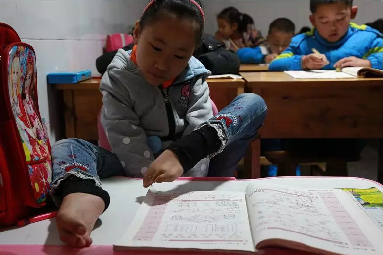 万源“折翼”女孩“脚上功夫”了得