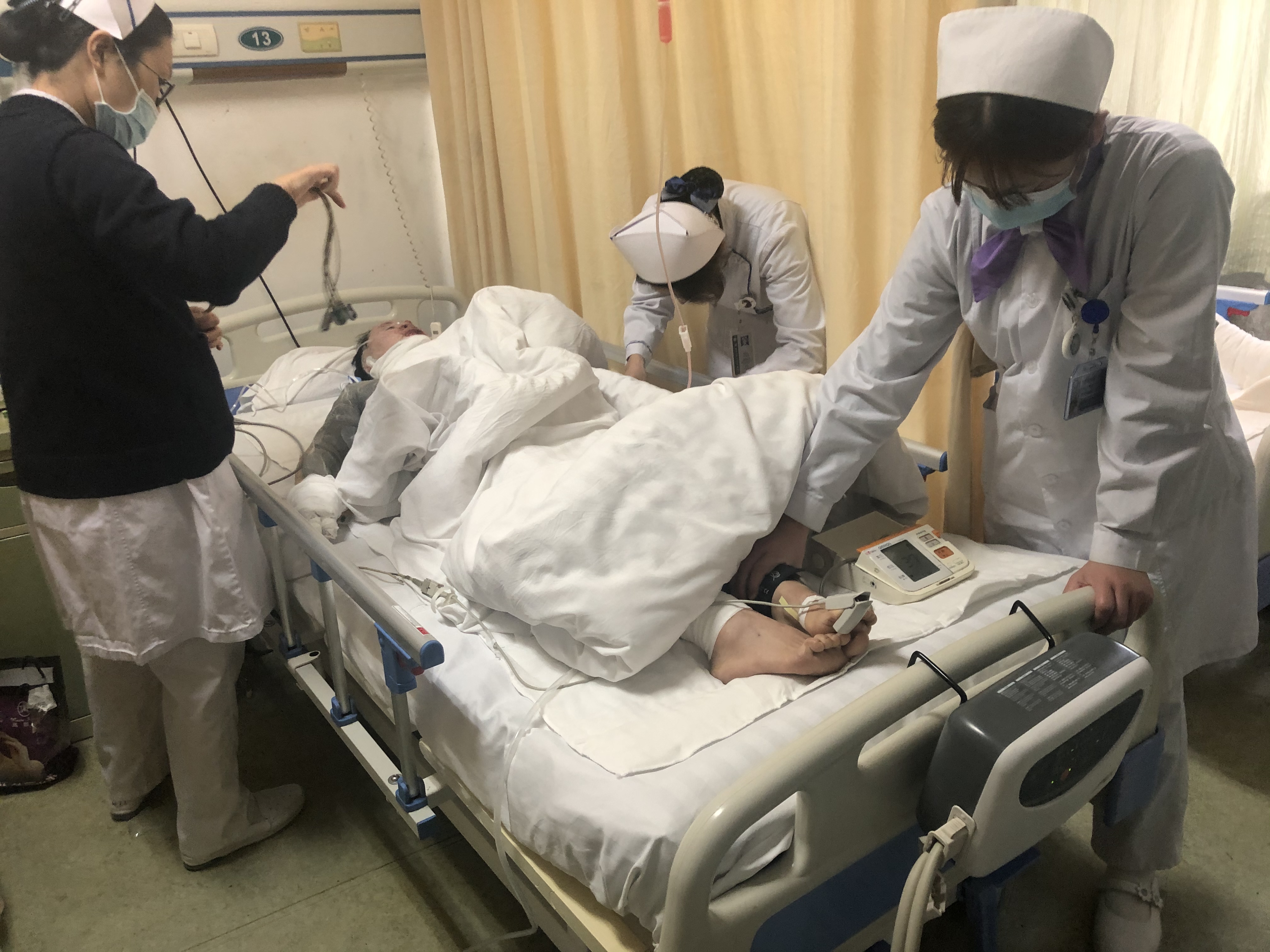 美女辣妈拔火罐烧伤如戴紧箍咒,美妈凌晨拔火罐烧伤