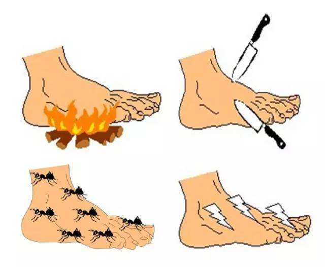 糖尿病手脚麻木全身酸痛,糖尿病手脚冰凉麻木治疗