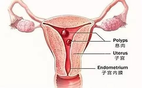 子宫异常出血的原因及注意事项,子宫异常出血和大姨妈有什么区别