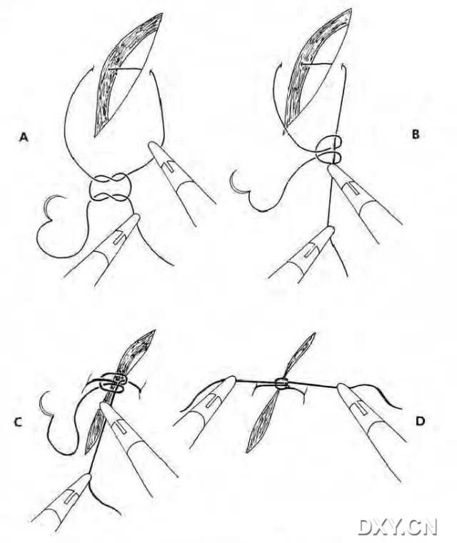 实用大全：腹腔镜下缝合与打结