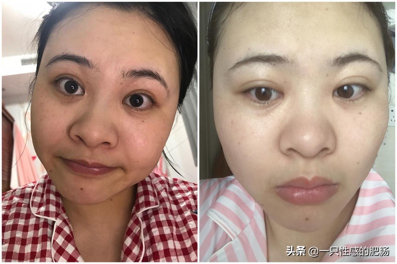 用了雅诗兰黛眼霜眼酸,雅诗兰黛小棕瓶眼霜淡眼纹么