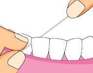 牙缝大是福是祸,牙缝宽什么命运