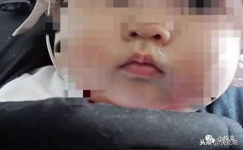 宝宝流黄鼻涕半个月还有点咳嗽,宝宝流了一个星期黄鼻涕