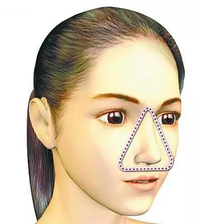 挤痘痘之后的正确处理方式,挤痘痘后正确处理方法