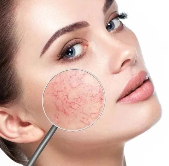 纳尼实力到底怎么样,纳尼所有皮肤