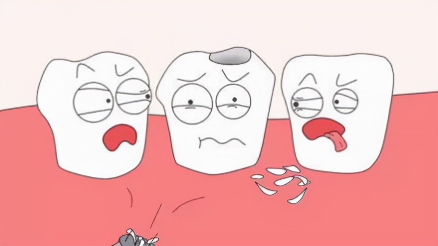 牙齿那些事动画,牙齿什么事都没就要做根管