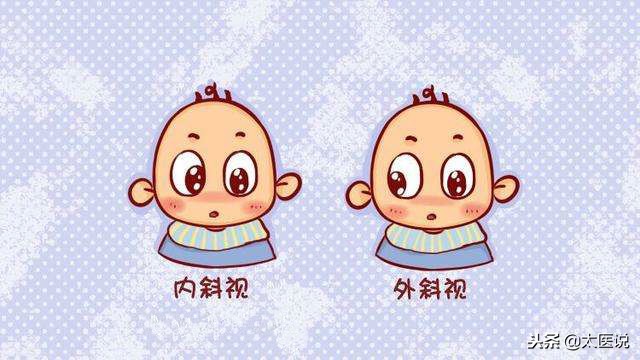 幼儿弱视和斜视的预防和护理,高度近视眼睛斜视怎么预防加深