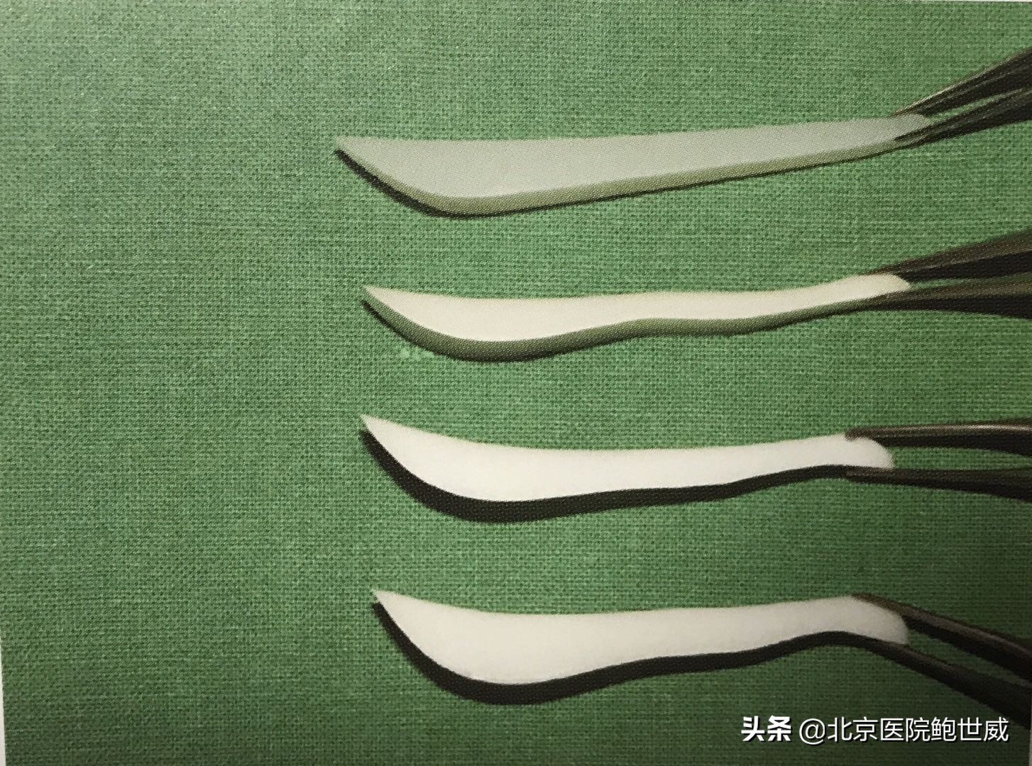 隆鼻为什么会假体外露,假体隆鼻外露怎么修复