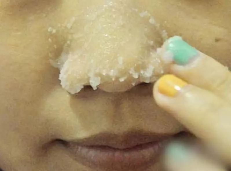 简单省钱去黑头的小妙招,懒人去黑头小妙招一周去黑头