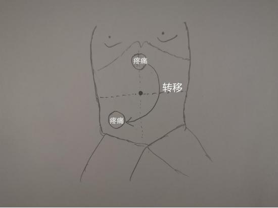 热血外科|Dr.Liu聊科普:阑尾炎究竟是何方妖孽？