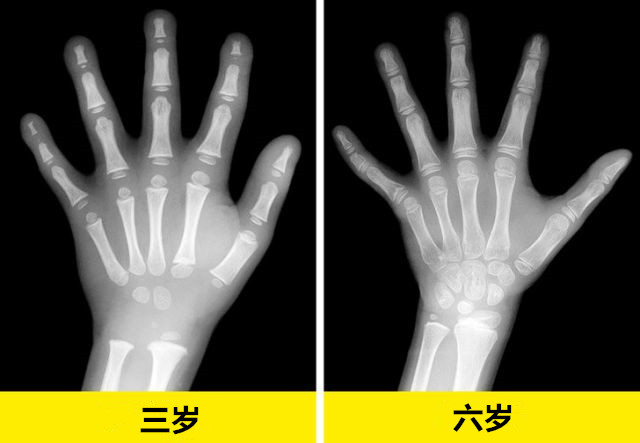 x射线下的人体图,x射线照片