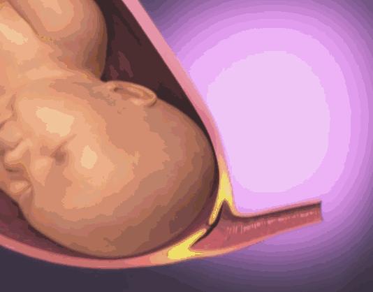 生宝宝到底有多疼看完这个就知道,生孩子到底有多疼让爸爸告诉你